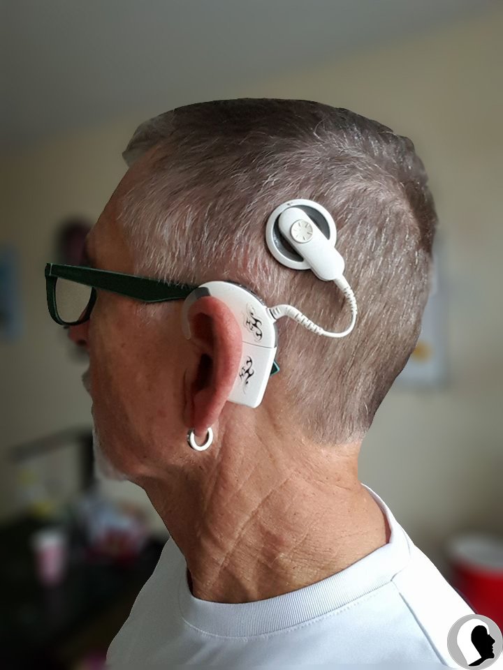 CI Kopf 2018 Erwachsen